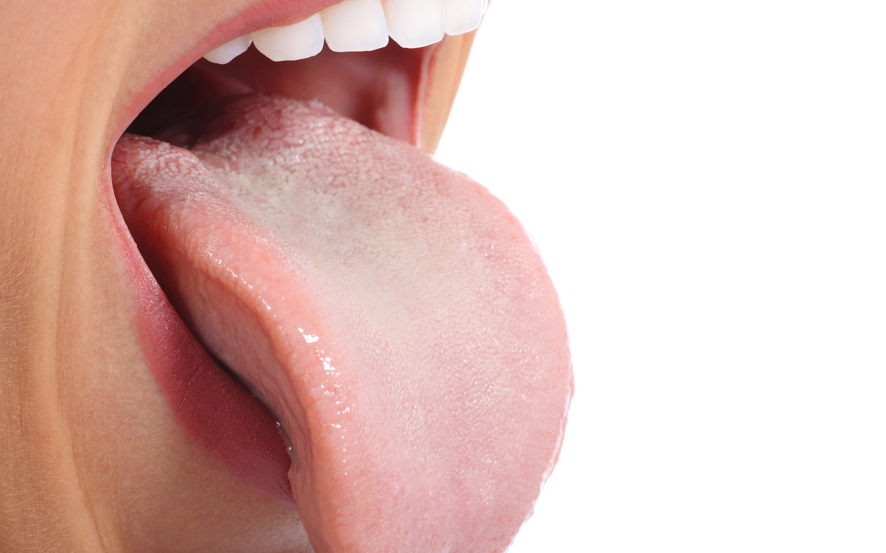 Соленая слюна во рту. Бактериальный глоссит. Склерозирующий глоссит. Кандидозный стоматит стоматит.