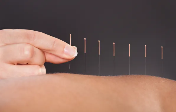 Back, skin, fingers, acupuncture