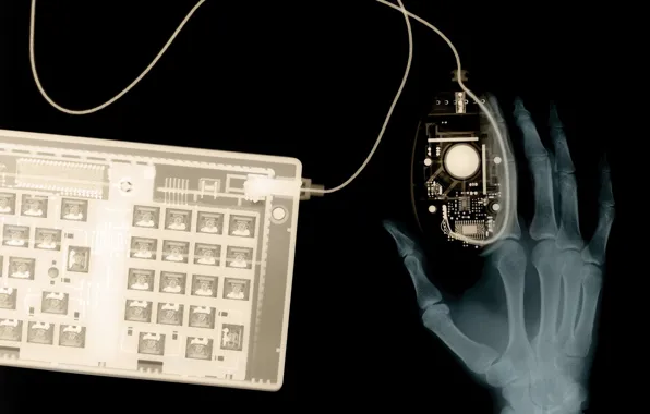 Hand, x-ray, keyboard