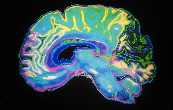 Brain, radiography, dye color
