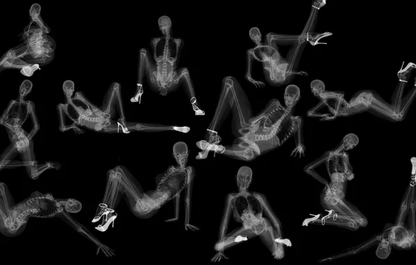 Picture style, girls, x-ray
