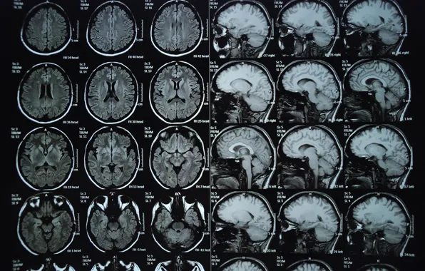 Sake, brain, X-rays