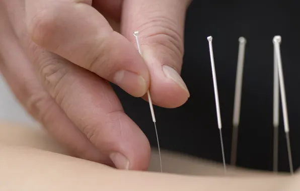 Hands, skin, fingers, needles, acupuncture