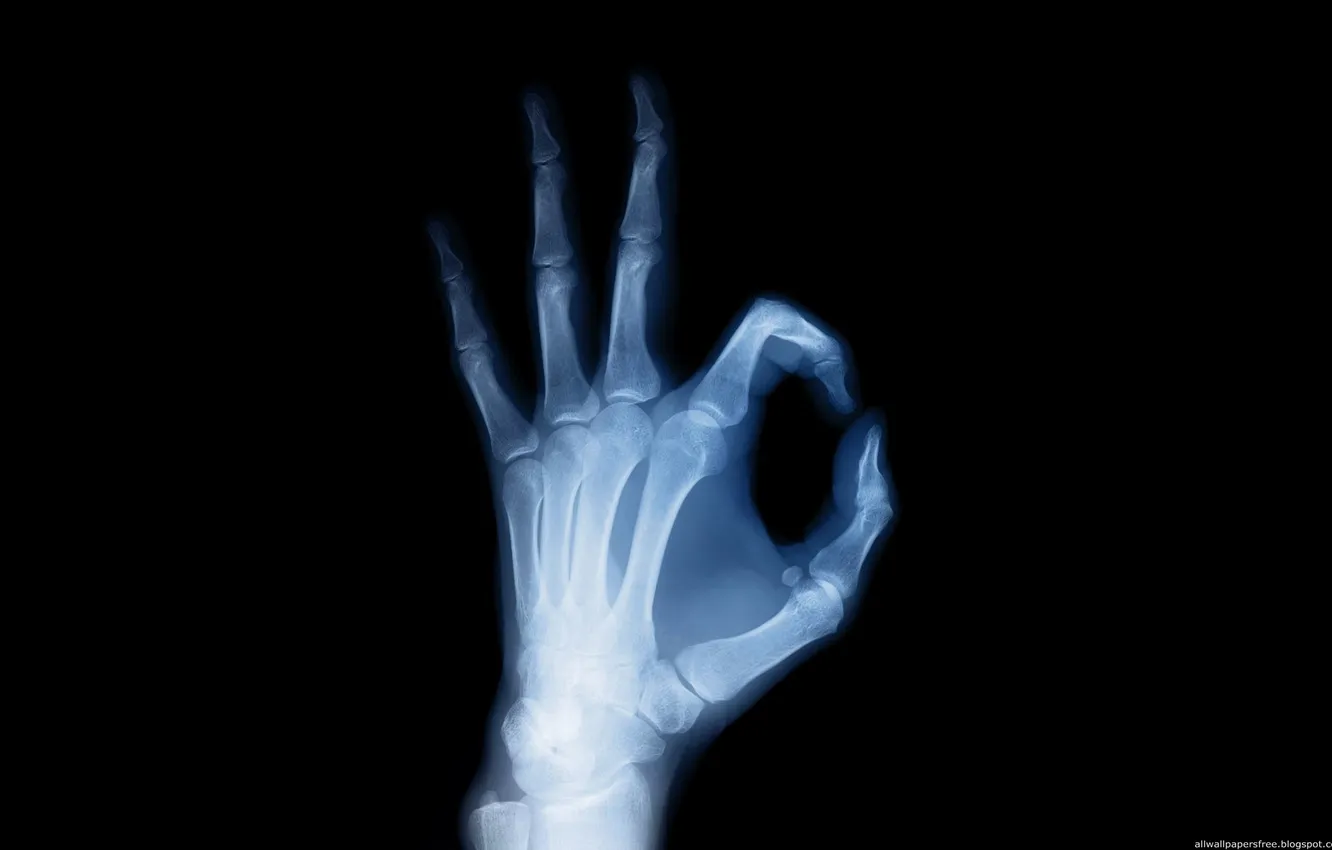 Photo wallpaper hands, bones, skeleton, x-ray