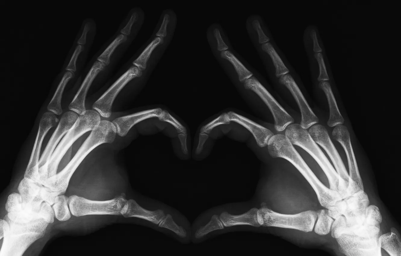 Photo wallpaper Hands, X-ray, Limbs, Fingers