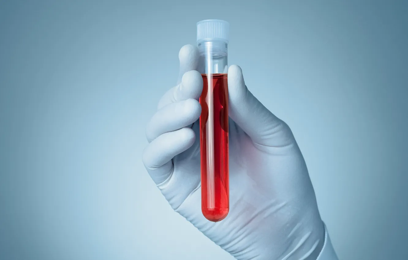 Photo wallpaper blood, gloves, sample
