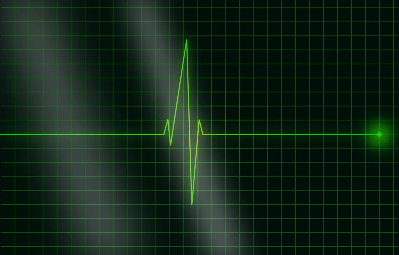Photo wallpaper pulse, cardiogram, frequency