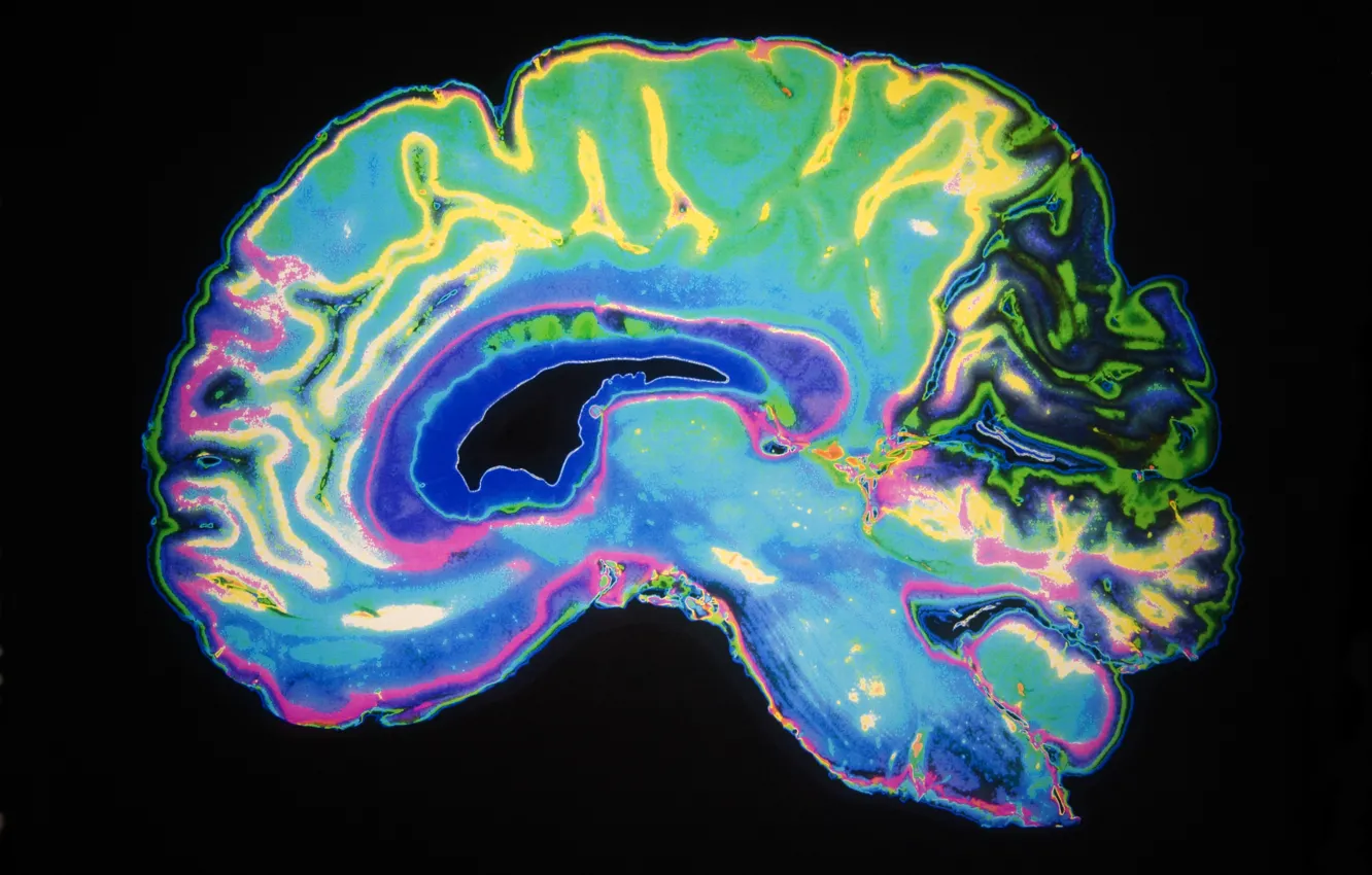 Photo wallpaper brain, radiography, dye color