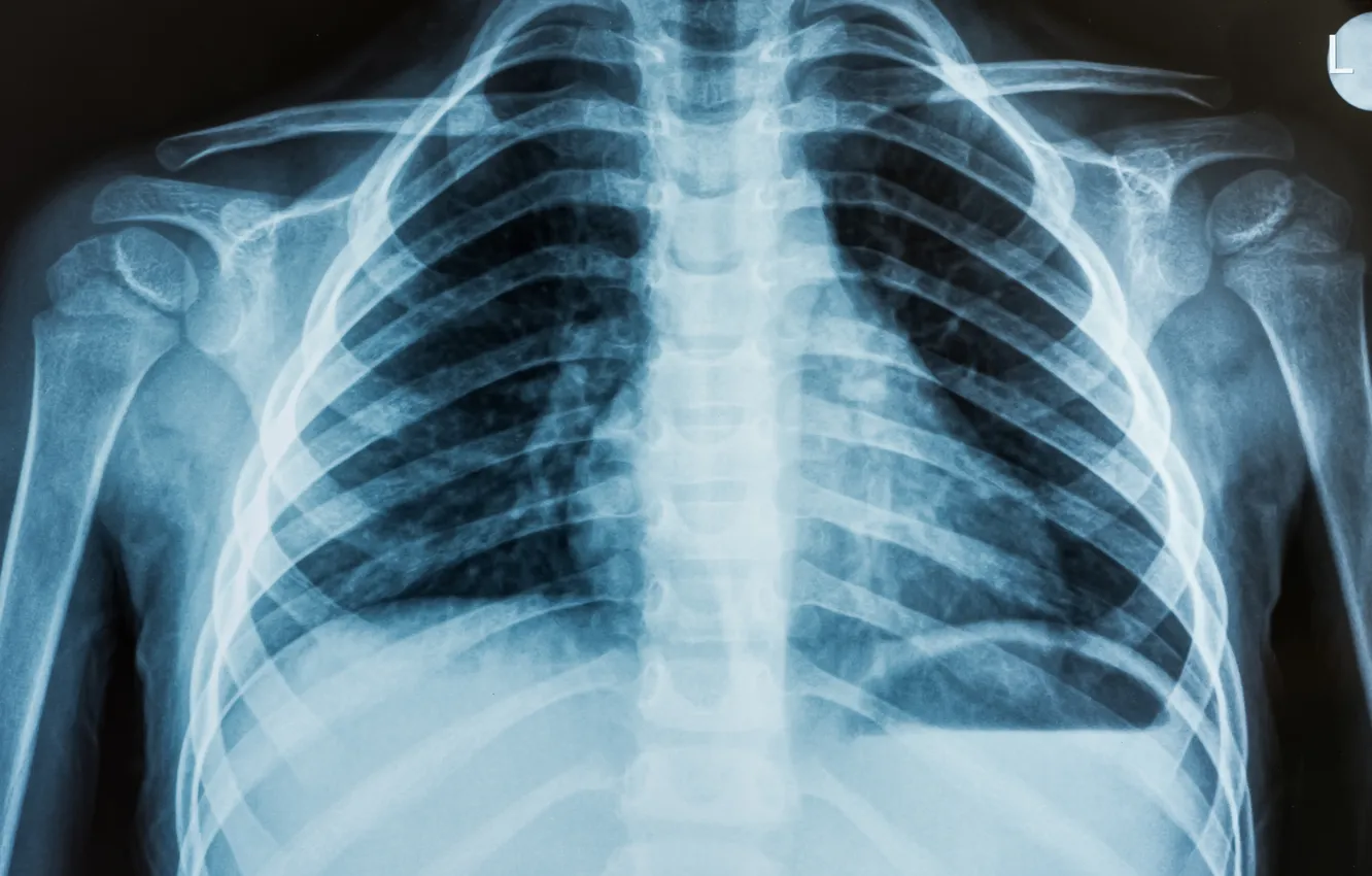 Photo wallpaper man, chest, ribs, x-ray