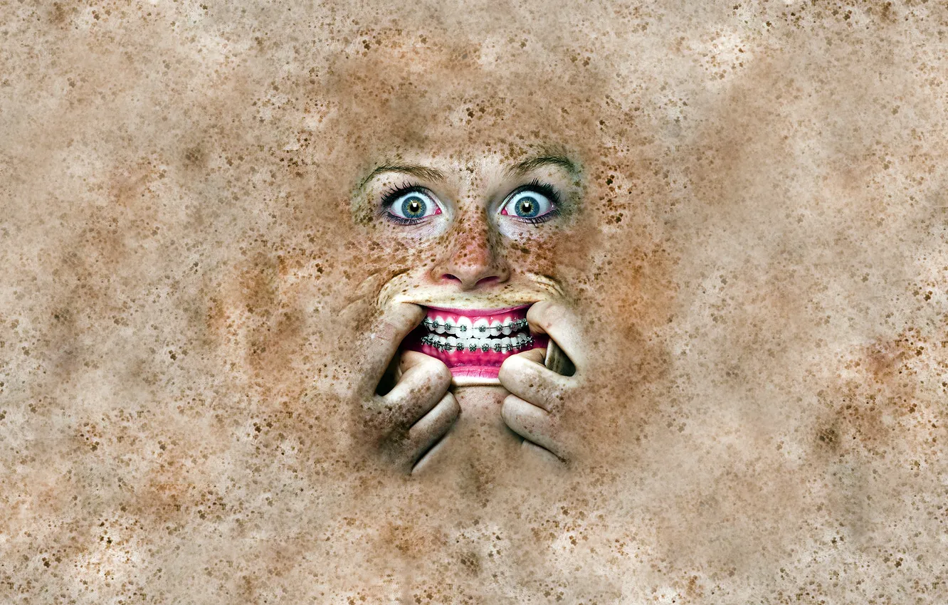 Photo wallpaper eyes, teeth, freckles, grimace, braces